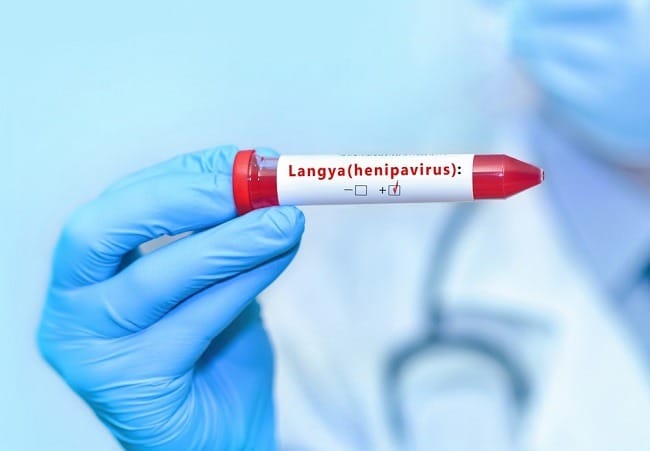 Mengenal Virus Langya dan Potensi Penularannya - Alodokter