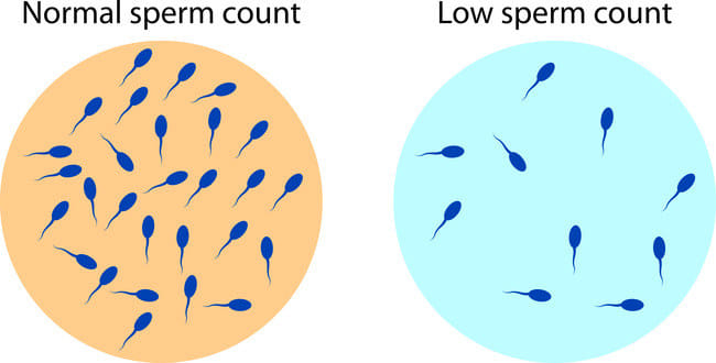 Oligospermia - Alodokter