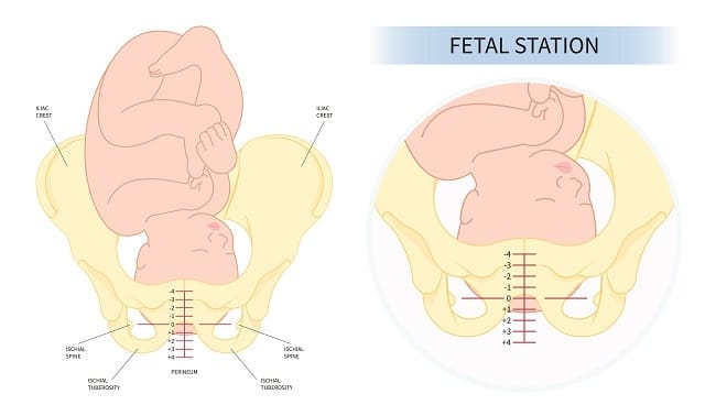 Distosia Bahu - Alodokter