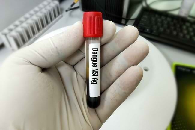 Mengenal Pemeriksaan NS1 untuk Demam Berdarah Dengue - Alodokter