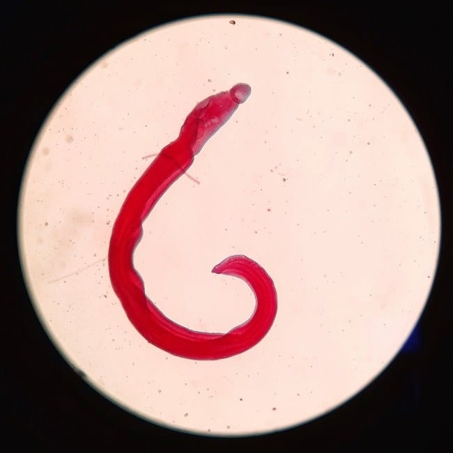 Skistosomiasis - Alodokter