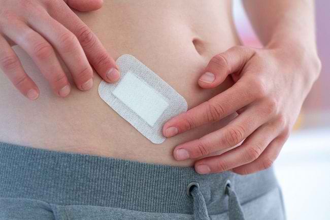 Ketahui Lama Penyembuhan Luka Operasi dan Faktor yang Memengaruhinya - Alodokter