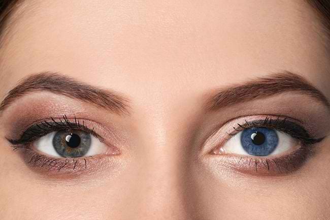 Heterochromia, Kenali Berbagai Jenis dan Penyebabnya - Alodokter