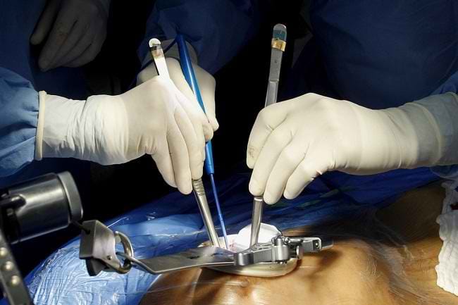 Mengenal Torakotomi, Operasi Membuka Rongga Dada - Alodokter