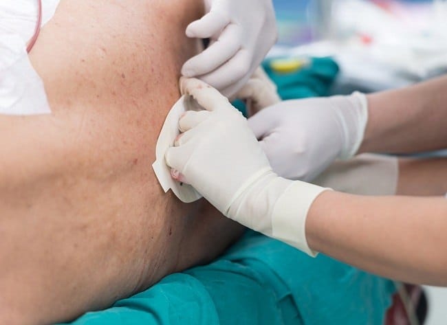 Mitos dan Fakta Seputar Bius Epidural Saat Persalinan - Alodokter