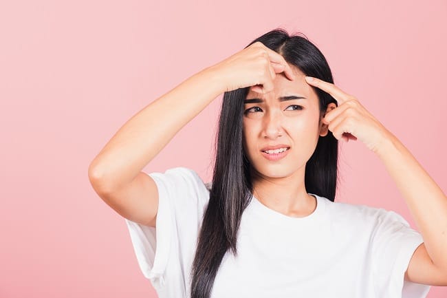 Isotretinoin Oral - Alodokter