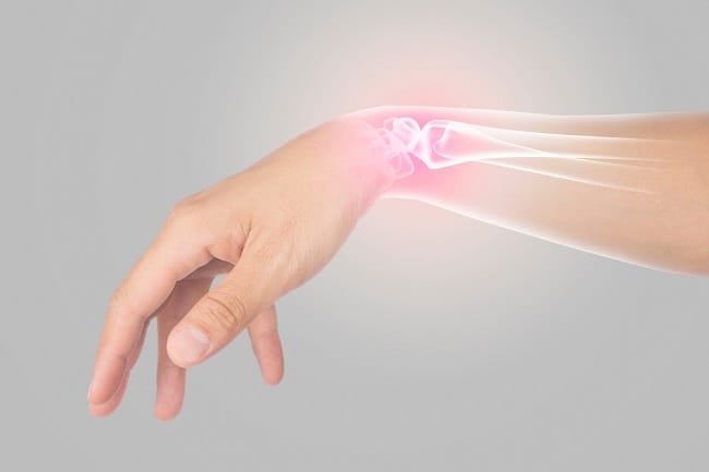 Fungsi Tulang Pergelangan Tangan dan Gangguan yang Dapat Terjadi - Alodokter