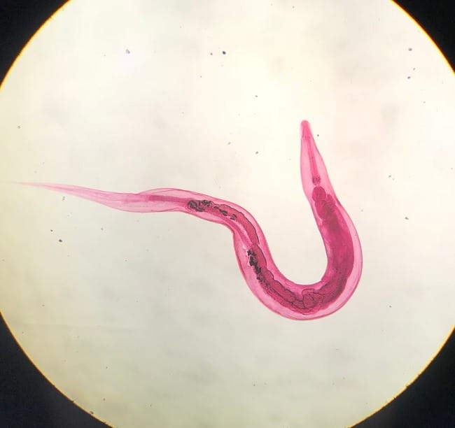 Cacing Kremi - Alodokter