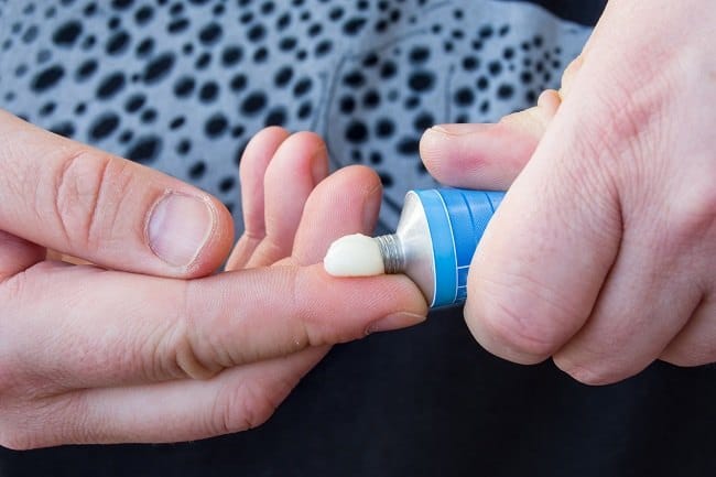 Prilocaine Topikal - Alodokter