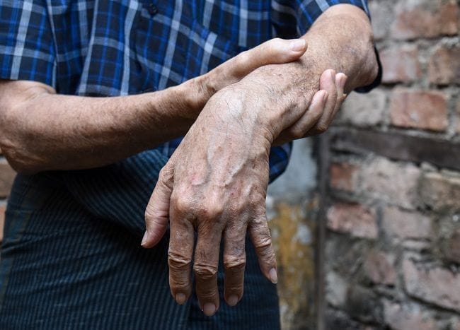 Pyridostigmine - Alodokter