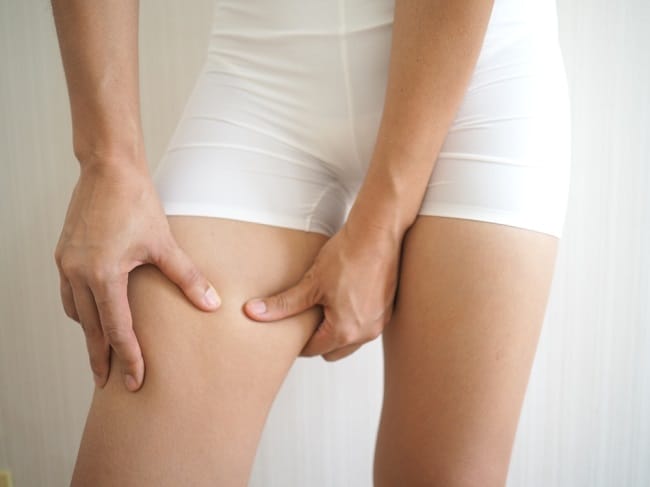 Selangkangan Lecet, Ini Cara Mudah Mengatasinya - Alodokter