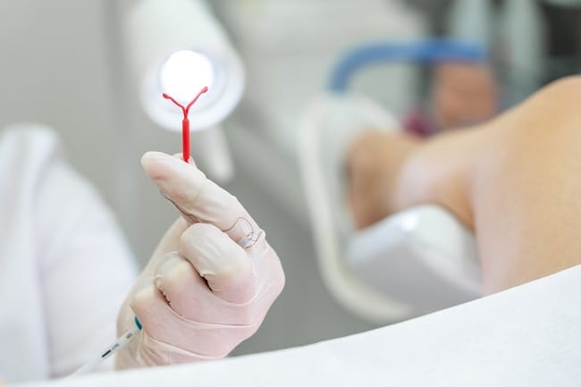 8 Efek Samping KB IUD dan Cara Mengatasinya - Alodokter
