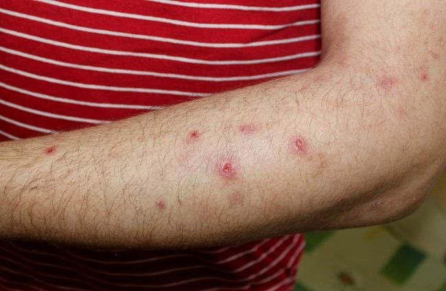 5 Obat Darah Manis di Apotek - Alodokter