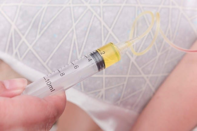 Infus Whitening, Kenali Kandungan dan Efek Sampingnya