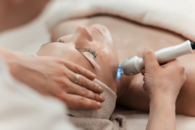5 Manfaat Laser Wajah untuk Kulit yang Sehat dan Bercahaya