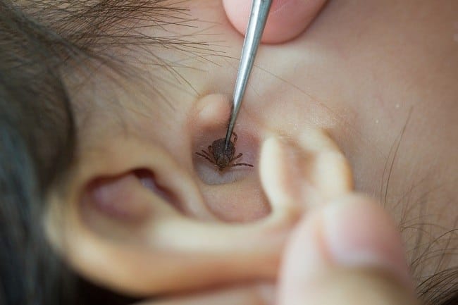 5 Cara Mengeluarkan Hewan dari Telinga dengan Aman - Alodokter