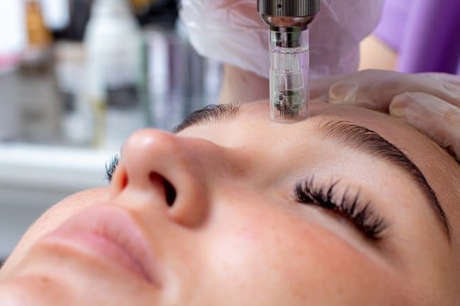 Microneedling, Mengenal Manfaat dan Efek Sampingnya - Alodokter