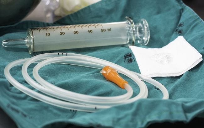 Bilas Lambung, Prosedur Medis untuk Atasi Keracunan - Alodokter