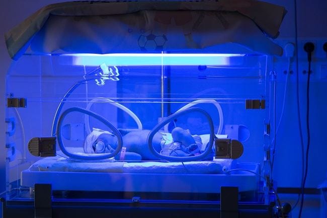 Atresia Bilier - Alodokter