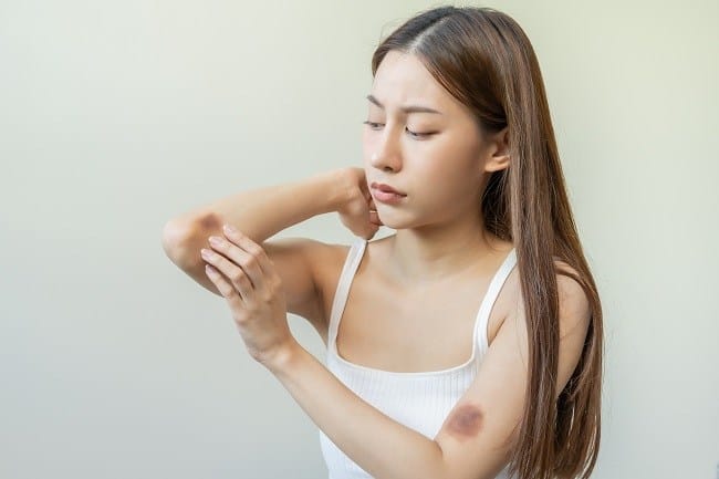 Eltrombopag - Alodokter