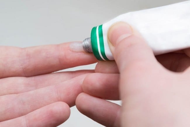 7 Merek Obat Hydrocortisone yang Ada di Apotik - Alodokter