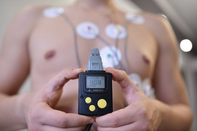 Holter Jantung dan Hal-hal Penting di Dalamnya - Alodokter