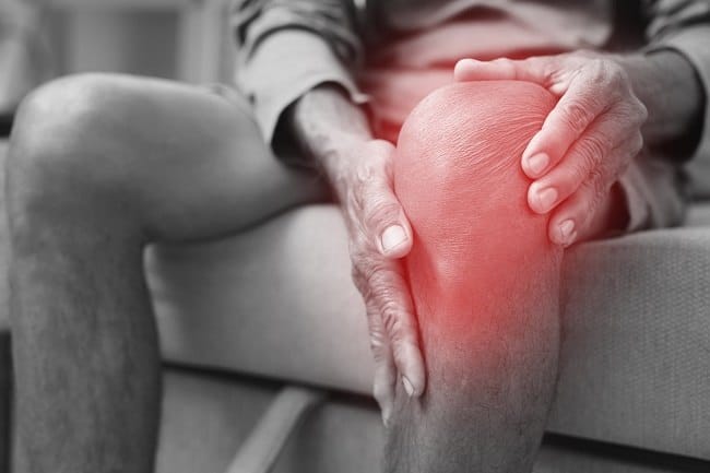 10 Obat Rematik yang Bagus untuk Sendi - Alodokter