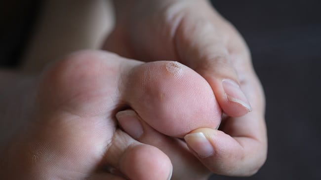 Obat Mata Ikan yang Bisa Dibeli Tanpa Resep Dokter - Alodokter