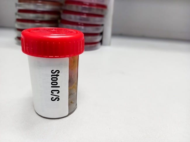 Kultur Feses, Ini yang Harus Anda Ketahui - Alodokter