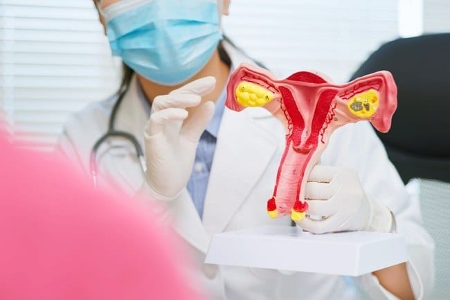 Kista Ovarium, Kenali Faktor Risiko dan Gejalanya - Alodokter