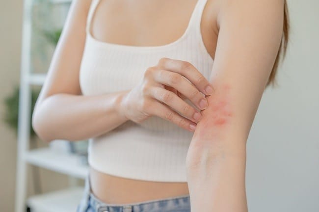 Bintik Merah di Tangan, Kenali Penyebab dan Penanganannya - Alodokter