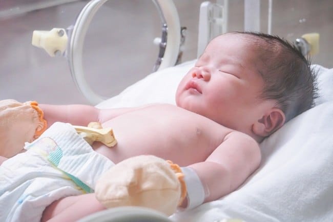 Gastroschisis, Ketika Organ Pencernaan Bayi di Luar Perut - Alodokter