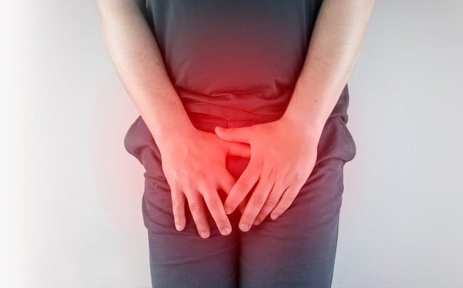 Chancroid - Alodokter