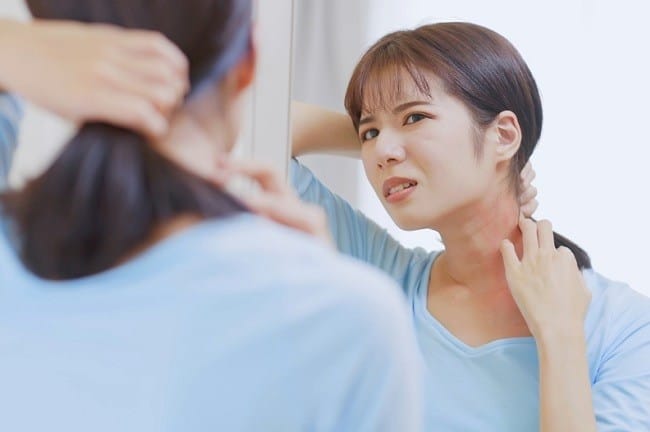 Penyebab Jerawat di Leher dan Cara Cepat Mengatasinya - Alodokter