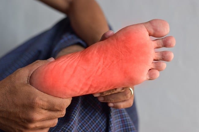 Telapak Kaki Terasa Panas, Ketahui 10 Penyebabnya - Alodokter