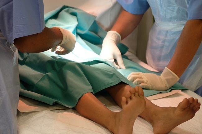 Sunat Klamp, Ketahui Jenis Beserta Kelebihan dan Kekurangannya - Alodokter