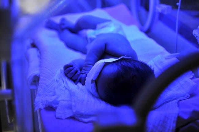 Tingkat Bilirubin Normal Bayi Baru Lahir yang Perlu Bunda Ketahui - Alodokter