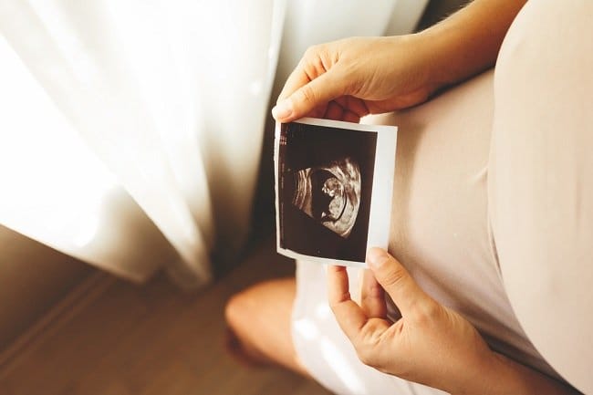 Janin 2 Bulan, Inilah Perkembangan yang Perlu Diketahui - Alodokter