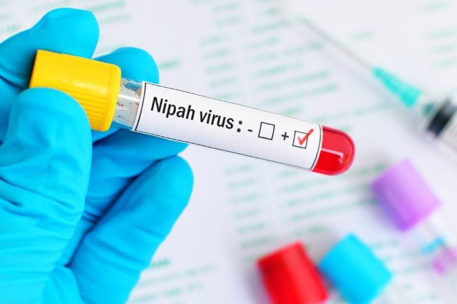 Bahaya Virus Nipah dan Potensinya Menjadi Pandemi Baru - Alodokter