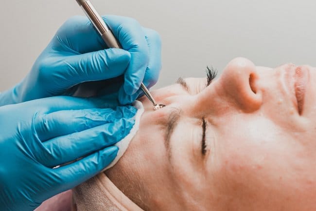 8 Cara Menghilangkan Milia di Wajah yang Efektif - Alodokter