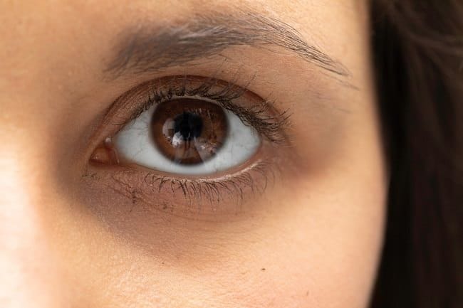 Mata Hitam, Inilah 8 Penyebab hingga Cara Mencegahnya - Alodokter