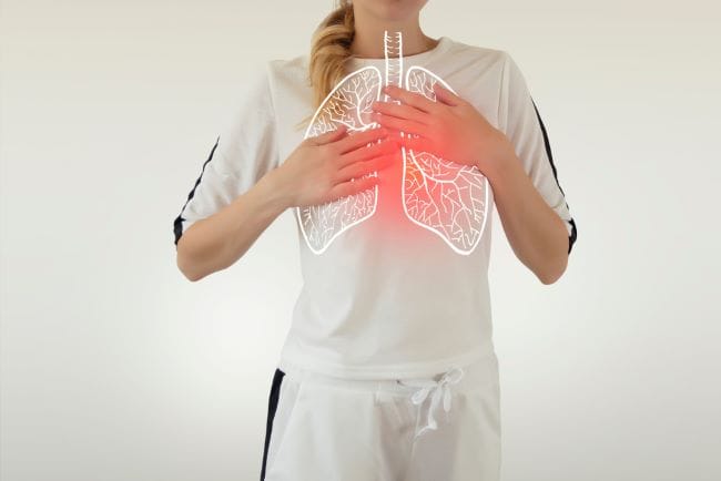 8 Bahaya White Lung Pneumonia yang Perlu Diketahui - Alodokter