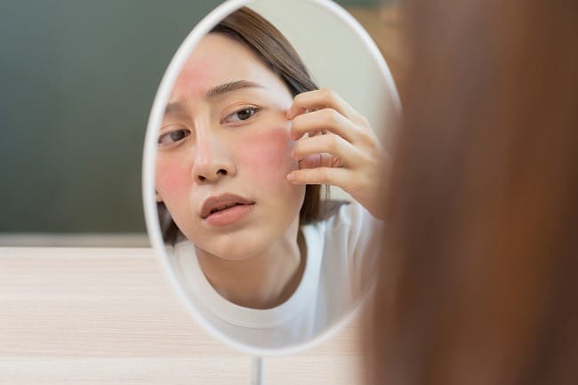 8 Cara Mengatasi Kulit Wajah Kering dan Mengelupas - Alodokter