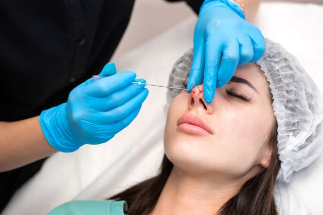 Tanam Benang Hidung, Ketahui Cara Kerja dan Risikonya - Alodokter