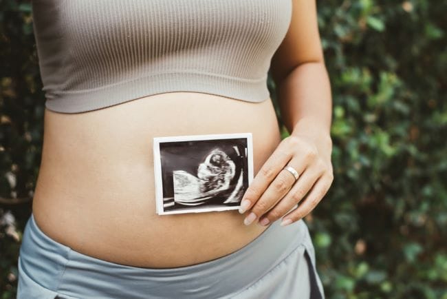 Ukuran Janin 3 Bulan dan Proses Perkembangannya - Alodokter