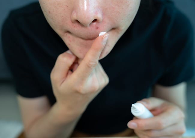 Nicotinamide Topikal