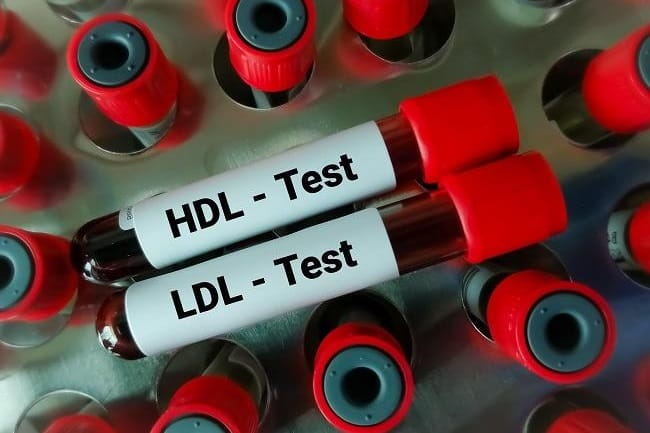 7 Obat Kolesterol Tinggi yang Efektif Turunkan Kadar Kolesterol Jahat - Alodokter