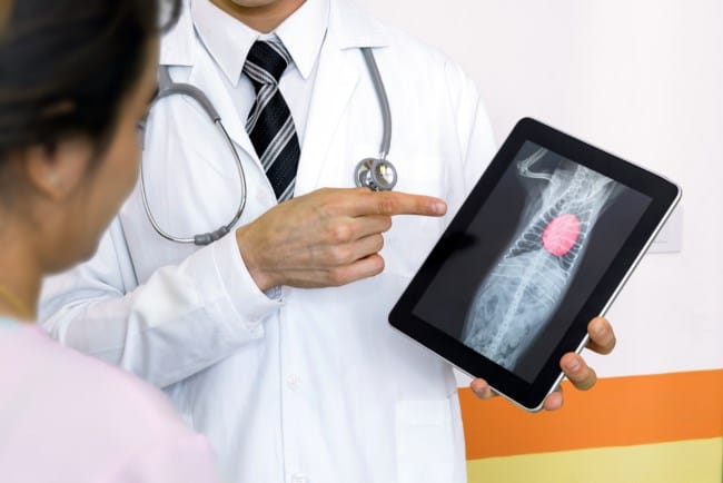 6 Penyebab Jantung Bengkak dan Pengobatannya - Alodokter