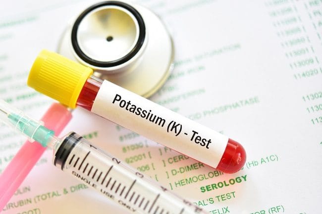 7 Pantangan Kekurangan Kalium agar Kadarnya Kembali Normal - Alodokter