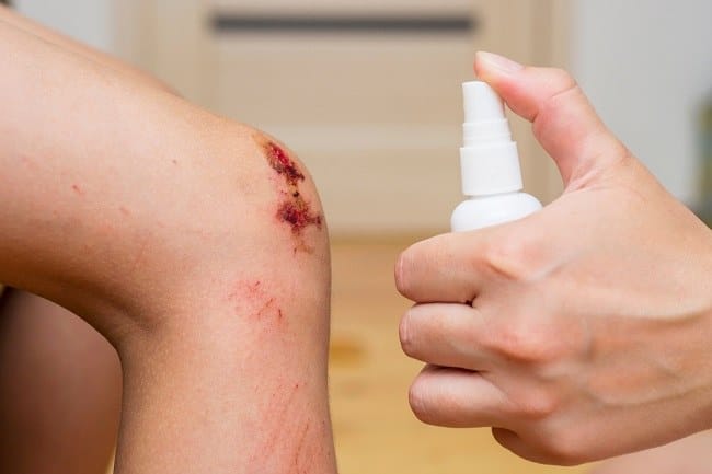 7 Obat Luka Luar yang Dapat Mempercepat Penyembuhan - Alodokter